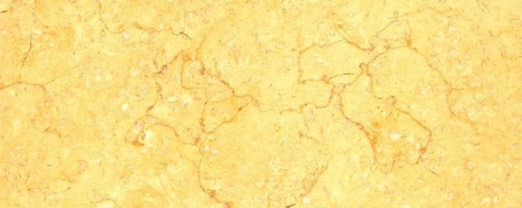 Мрамор Sunny Dark (Санни Дарк)
